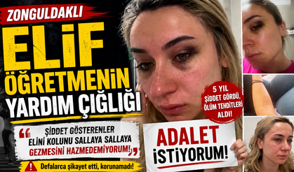 Zonguldaklı Elif Öğretmenin Yardım Çığlığı